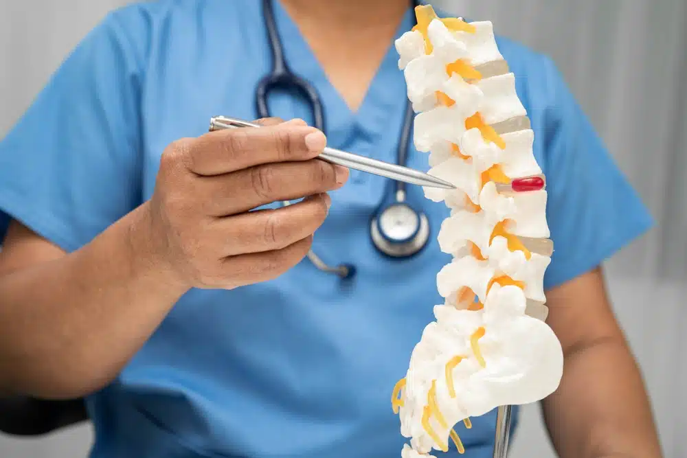 Doctor using a spinal model to explain nerve damage and device-related spinal complications.